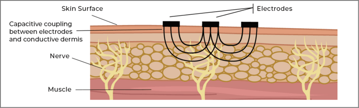 Electrode and Skin Contact-1