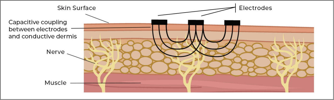 Electrode and Skin Contact-2
