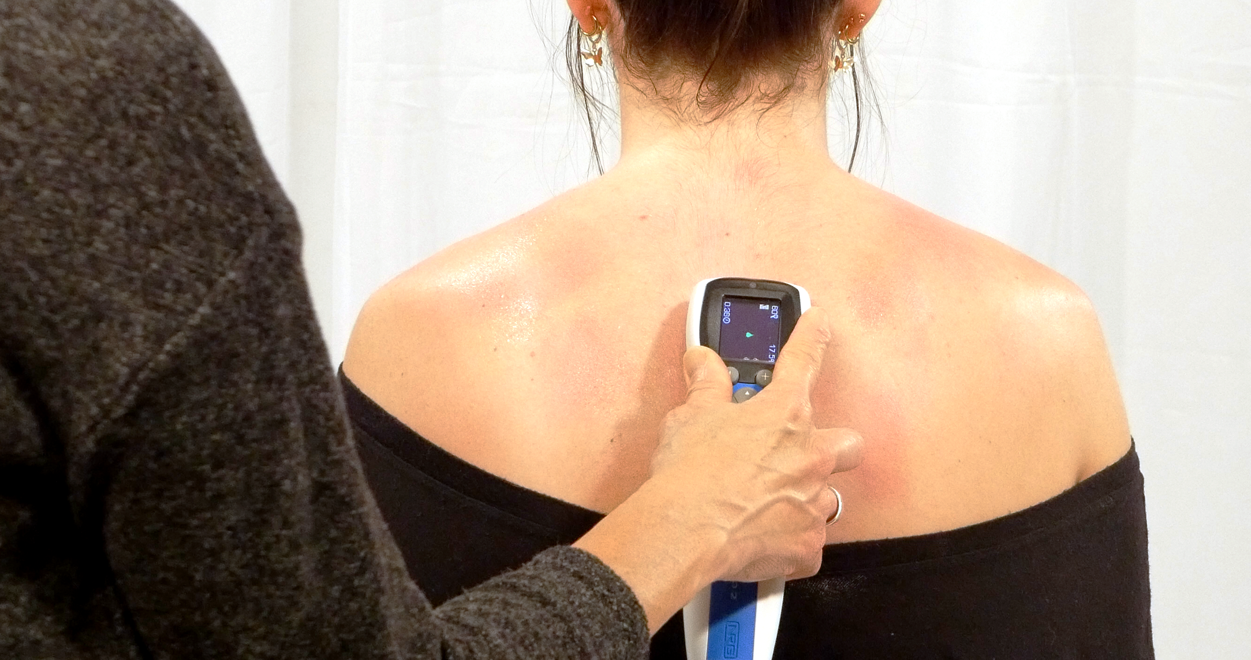 Treating upper back with InterX 5002