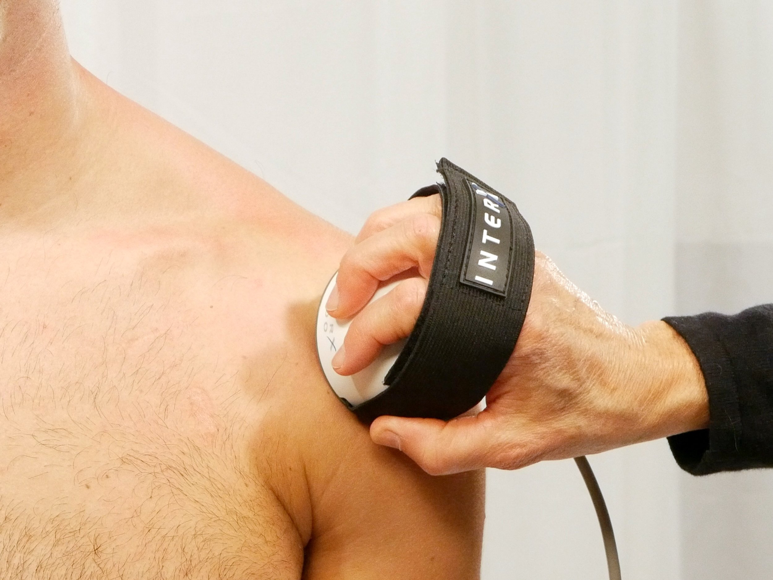 InterX Electrode: The Dome Application 1