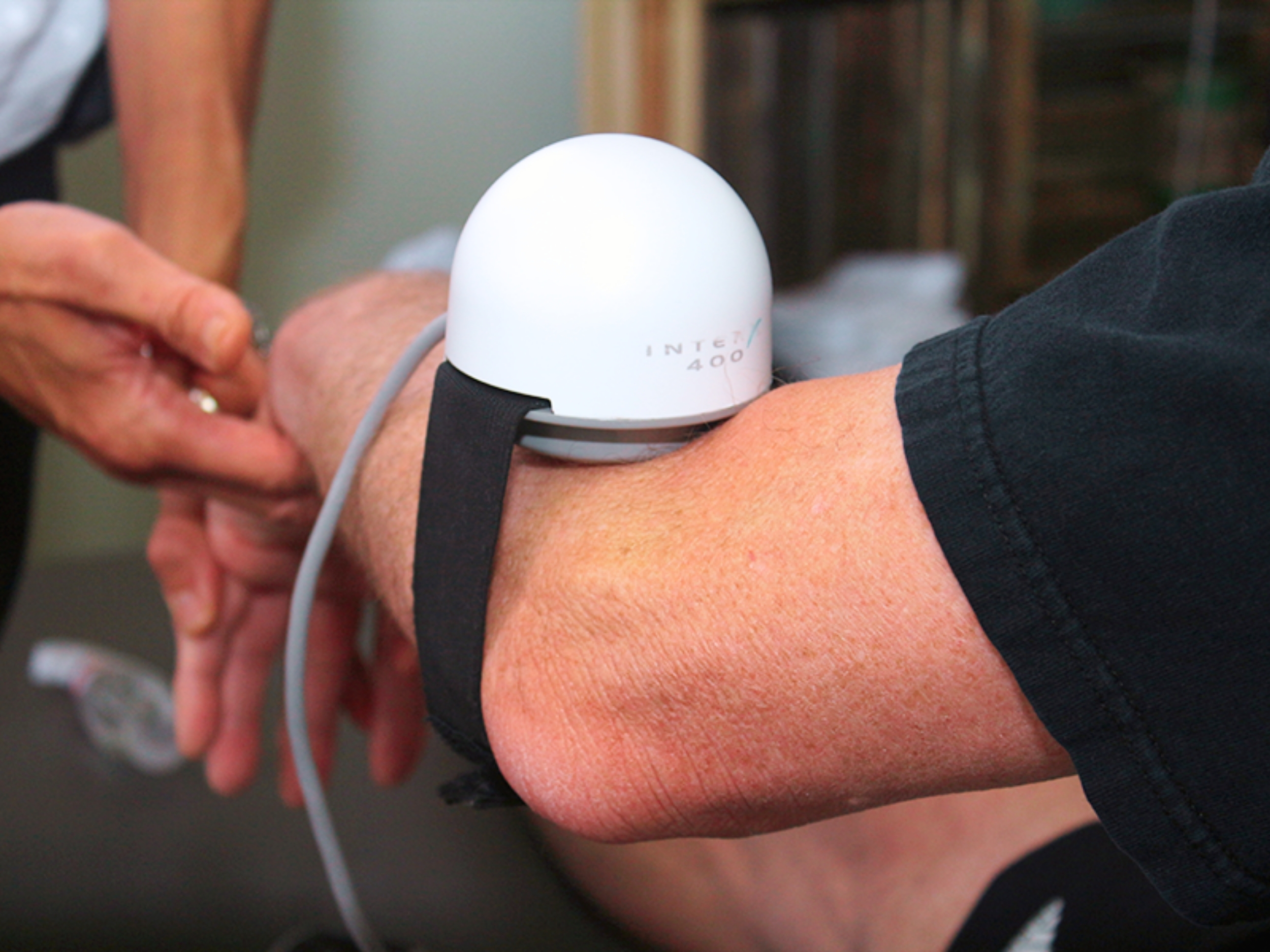InterX Electrode: The Dome Application 4