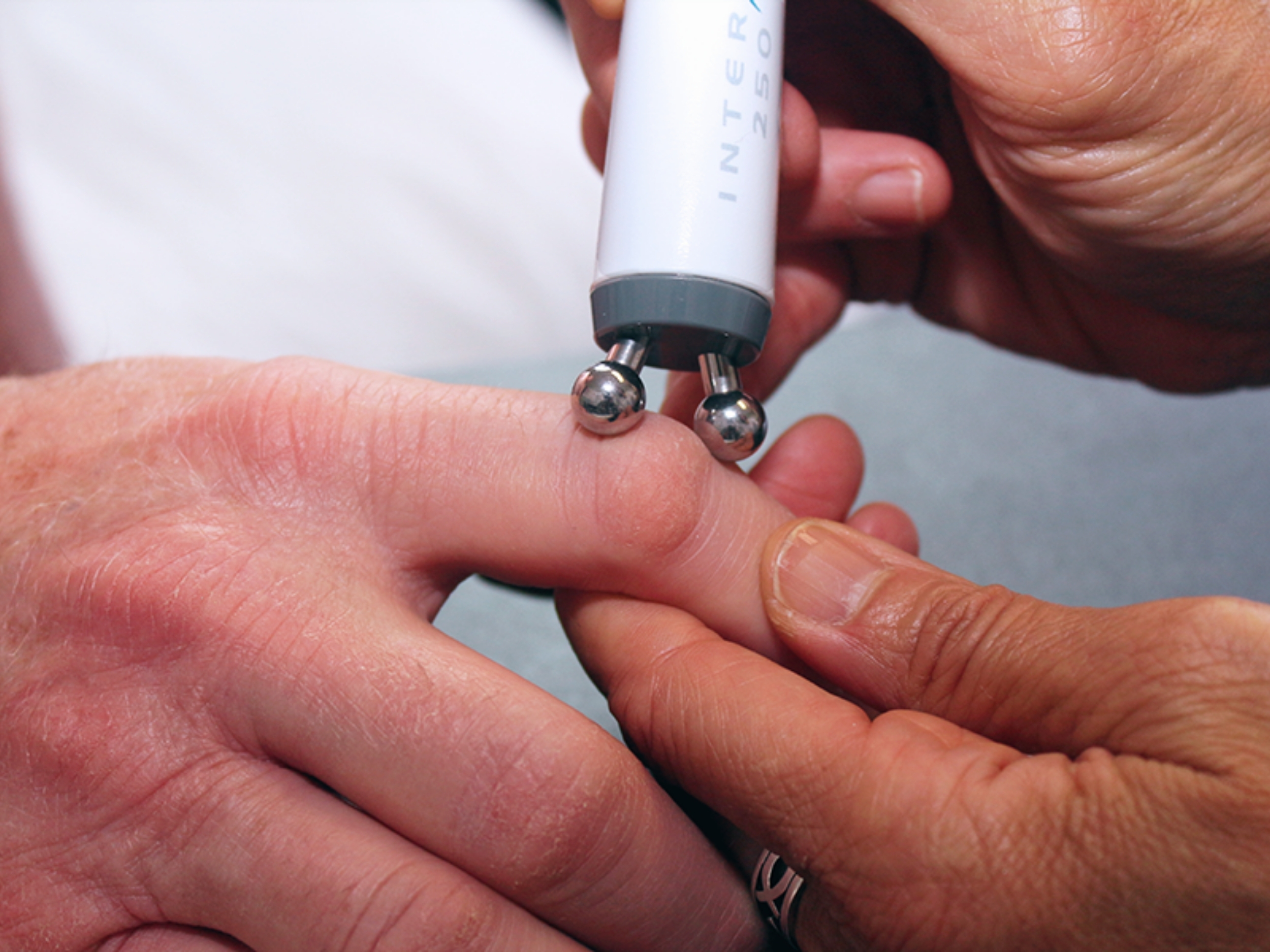 InterX Electrode: Small Soft Tissue Application 1
